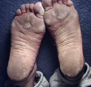 3304203189_4592c872d9_o